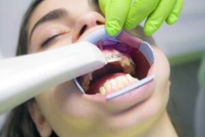 brackets