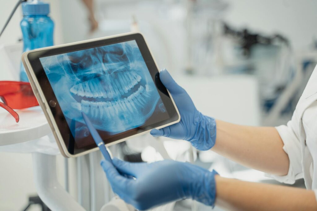 escáner intraoral