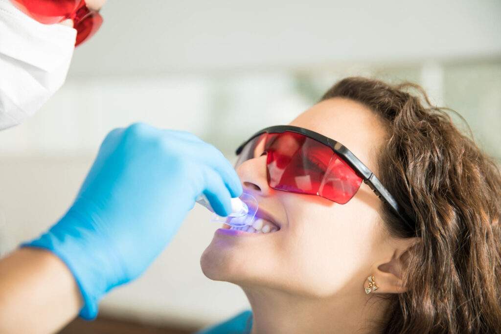 Estética dental: blanqueamiento, carillas y diseño de sonrisa — qué elegir según tu caso