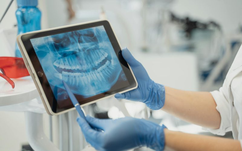 escáner intraoral